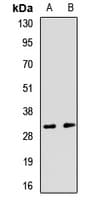 Polyclonal Rabbit anti-Human RGS13 Antibody (WB)