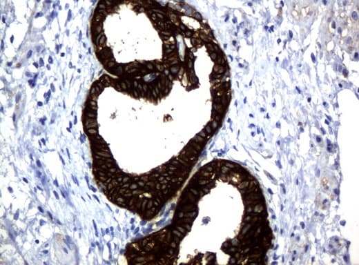 KRT18 / CK18 / Cytokeratin 18 Antibody (aa69-372, clone UMAB50)