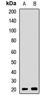 Polyclonal Rabbit anti-Human CSRP3 Antibody (IF, WB)