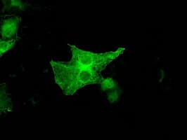 Monoclonal Mouse anti-Human GBP2 Antibody (clone OTI1E5, IHC, IF, WB)