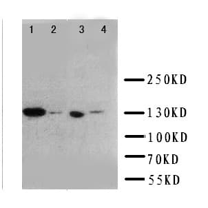 Polyclonal Rabbit anti-Human IGF1R / IGF1 Receptor Antibody (aa1353-1367, IHC, WB)