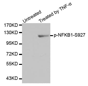 NFKB1 / NF-Kappa-B Antibody (phospho-Ser927)