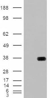 IHC-plus™ Polyclonal Goat anti-Human HADH Antibody (aa234-245, IHC, WB)