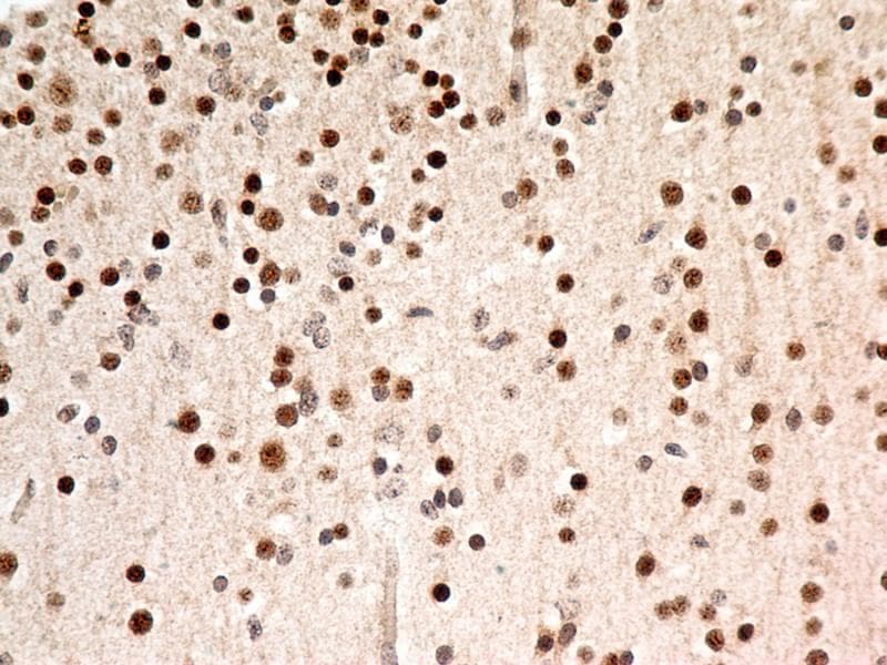 FOXP1 Antibody (clone JC12)