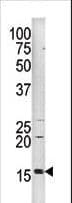 Polyclonal Rabbit anti-Human Histone H3 Antibody (phospho-Ser10, IHC, WB)