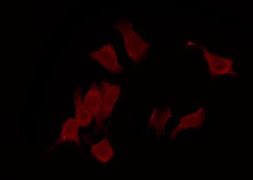 Polyclonal Rabbit anti-Human PIN1 Antibody (IF, WB)