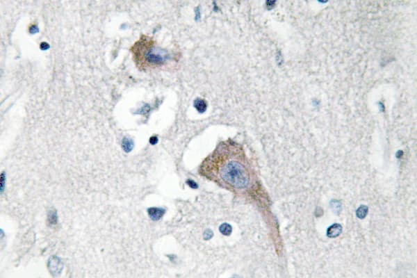 Polyclonal Rabbit anti-Human CaMKII Alpha+Delta Antibody (Met281, IHC, IF, WB)