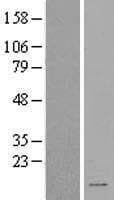 SPINK2 Protein (Over-Expression Lysate Myc-DDK (Flag))