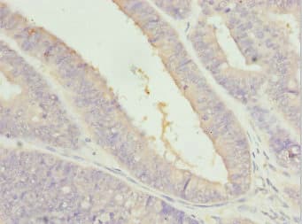 Polyclonal Rabbit anti-Human ZFAND3 / TEX27 Antibody (IHC)