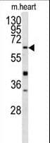 GGTLA1 / GGT5 Antibody (aa130-156)