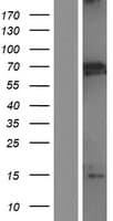 MBD1 Protein (Over-Expression Lysate Myc-DDK (Flag))