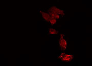 Polyclonal Rabbit anti-Human USP15 Antibody (IF, WB)