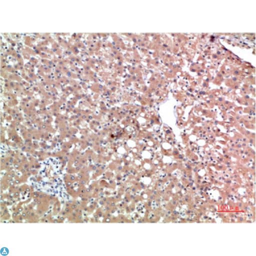 TTR / Transthyretin Antibody