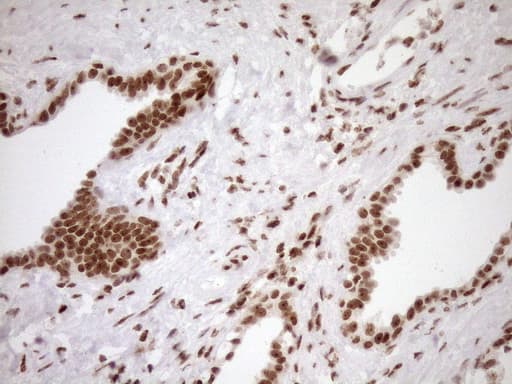 EXOSC1 / CSL4 Antibody (clone OTI1H9)