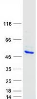 Human DCC1 / DSCC1 Protein (Recombinant Myc-DDK (Flag))