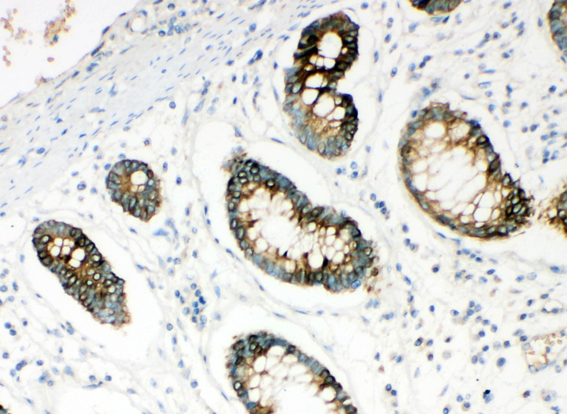 HYAL1 Antibody (aa32-47)