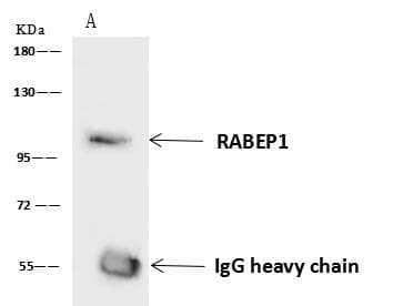 RABEP1 / Rabaptin-5 Antibody