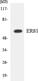 Polyclonal Rabbit anti-Human ER81 / ETV1 Antibody (aa23-72, WB)