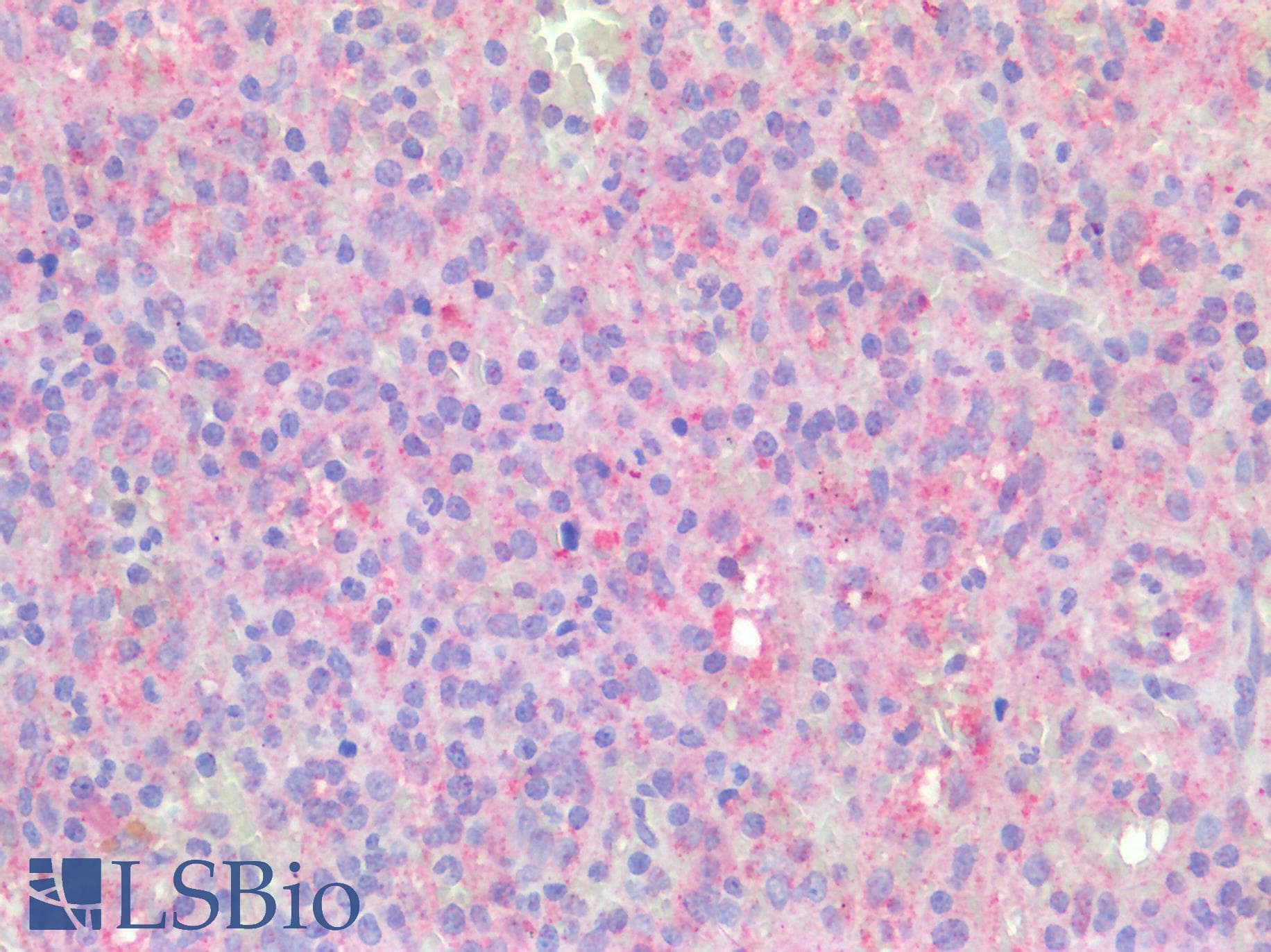 IHC-plus™ Polyclonal Rabbit anti-Human TNFRSF1B / TNFR2 Antibody (IHC)
