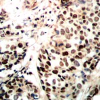 RAD51 / RECA Antibody (C-Terminus)