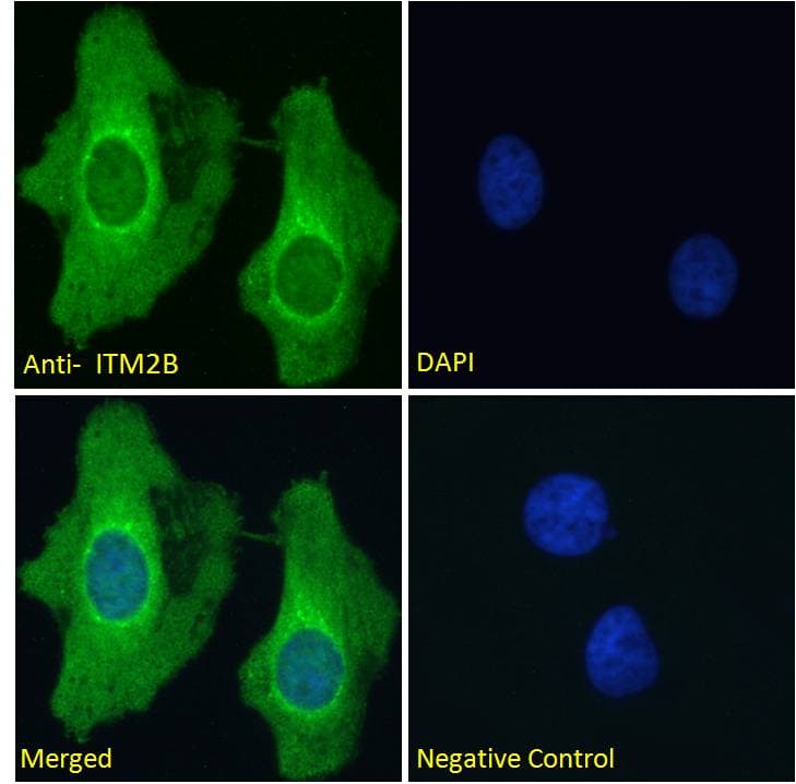 IHC-plus™ ABRI / ITM2B Antibody (aa224-238)