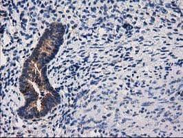 Monoclonal Mouse anti-Human ARFGAP1 Antibody (clone OTI1F6, IHC, IF, WB)