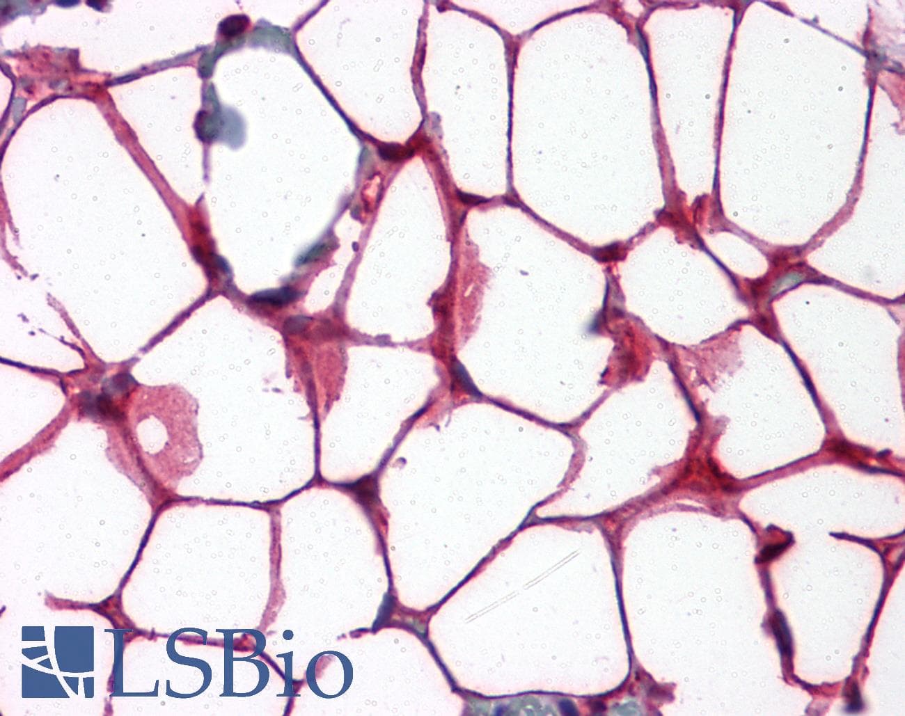 IHC-plus™ VCAM1 / CD106 Antibody (clone 6G9)