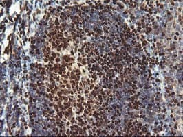 MEF2C Antibody (clone OTI1B6)