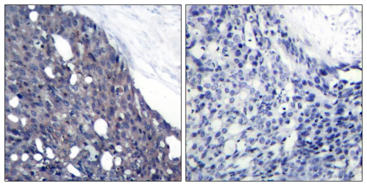 NFKBIA / IKB Alpha / IKBA Antibody (p42)