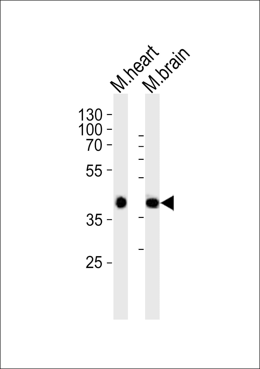 SBK1 Antibody (aa65-98)