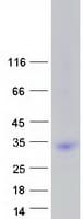 Human LRRN4CL Protein (Recombinant Myc-DDK (Flag))