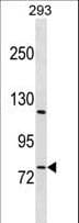 RBAK Antibody (aa74-102)