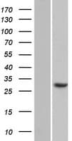 CCDC43 Protein (Over-Expression Lysate Myc-DDK (Flag))
