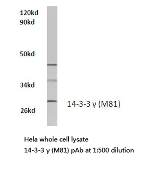 Polyclonal Rabbit anti-Human YWHAG / 14-3-3 Gamma Antibody (Met81, IHC, IF, WB)