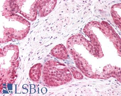 IHC-plus™ PICK1 Antibody (aa100-110)