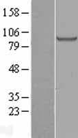 H6PD / G6PDH Protein (Over-Expression Lysate Myc-DDK (Flag))