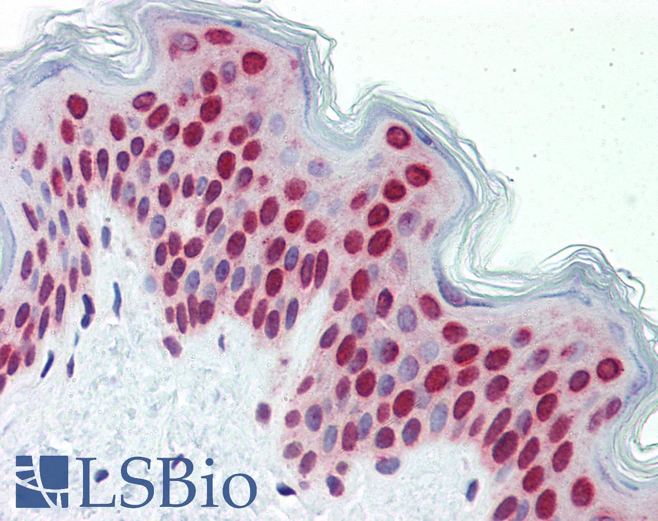 Polyclonal Rabbit anti-Human BXDC5 / RPF1 Antibody (aa45-94, IHC, WB)
