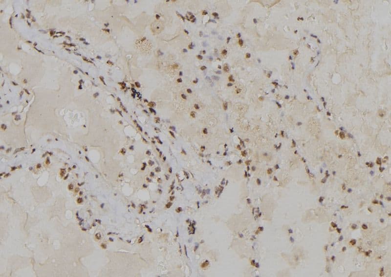 Polyclonal Rabbit anti-Human POLA2 / DNA Polymerase Alpha 2 Antibody (IHC, WB)