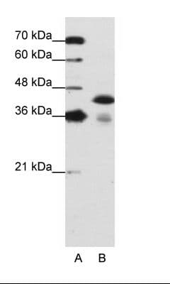 PathPlus™ TDP-43 / TARDBP Antibody (aa337-386)
