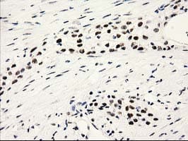 PYCRL Antibody (clone OTI8H6)