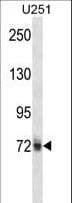 Polyclonal Rabbit anti-Human HNRPM / HNRNPM Antibody (aa21-50, IHC, WB)