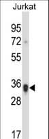 KIR2DS1 / CD158a Antibody (aa151-180)
