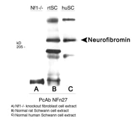 IHC-plus™ Neurofibromin / NF1 Antibody (aa27-41)