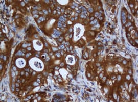 CAPN2 / Calpain 2 / M-Calpain Antibody (clone OTI3G1)