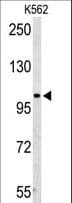 AMPD2 Antibody (aa187-217)