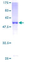 Human SOHLH2 Protein (Recombinant GST)