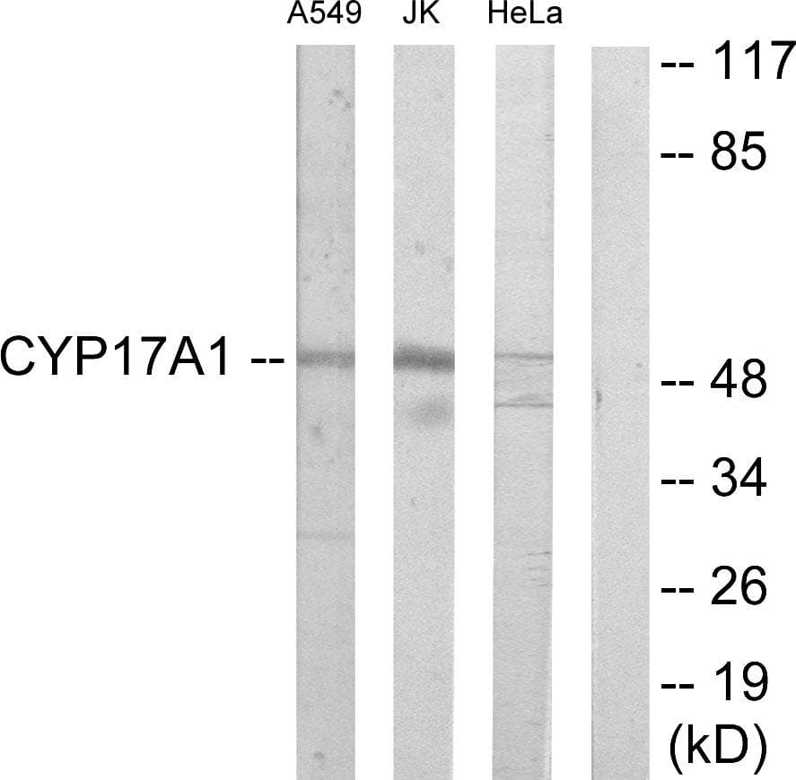 CYP17 / CYP17A1 Antibody