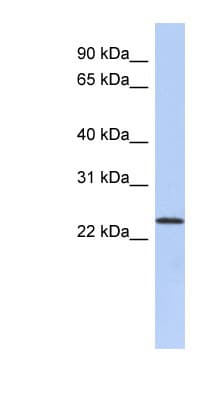 ULBP1 Antibody (N-Terminus)