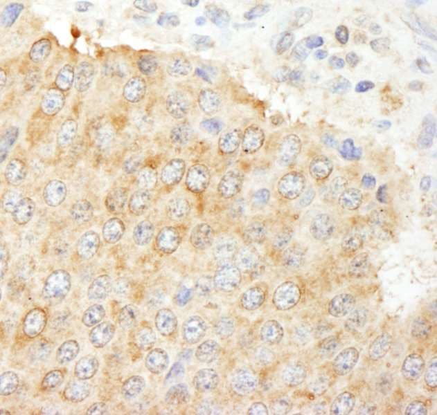 IHC-plus™ NF2 / Merlin Antibody (aa550-C-term)