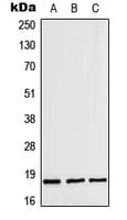 Polyclonal Rabbit anti-Human ZNHIT1 Antibody (Internal, WB)